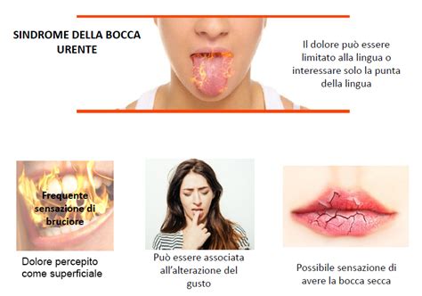 Schema della bocca con evidenziate le aree colpite dalla sindrome della bocca urente