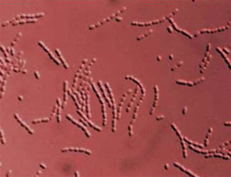 Micrografia di batteri lattici