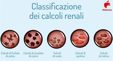 Schema di prevenzione calcoli renali con acido citrico