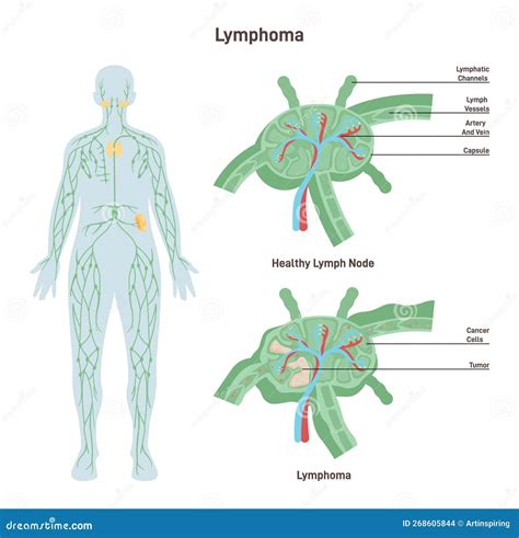 Schema del sistema immunitario e dei linfonodi