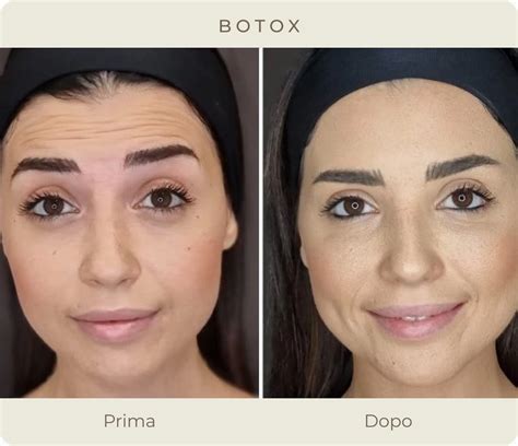 Immagine comparativa della pelle prima e dopo l'integrazione di silicio