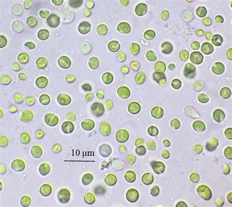 Cellule di Chlorella vulgaris con granuli d'amido