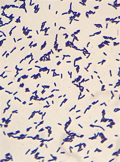 Microscopio che mostra batteri lattici
