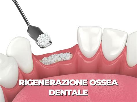 Schema che illustra l'azione del silicio sulla rigenerazione ossea