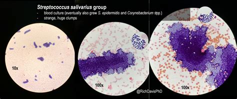 Rappresentazione schematica del microbiota orale con evidenziazione di Streptococcus salivarius e Streptococcus pyogenes