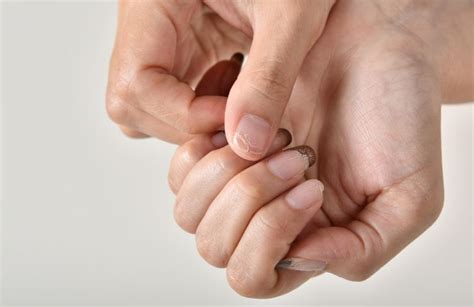 mani con unghie fragili e che si spezzano