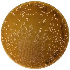 Colonie di Lactobacillus su terreno MRS agar