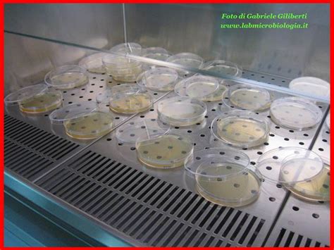 Incubazione delle piastre Petri