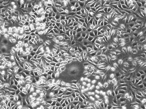 Immagini confocali di cellule L929 incorporate nell'idrogel dopo iniezione e coltura