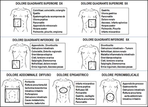 Schema degli organi addominali e delle possibili cause di dolore