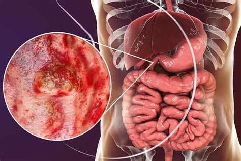 Icone che rappresentano le controindicazioni (es. ulcera, gravidanza, bambino)