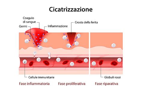 Schema del processo di guarigione delle ferite