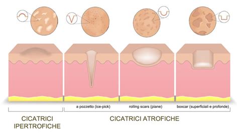 Tabella comparativa degli ingredienti per tipi di cicatrici