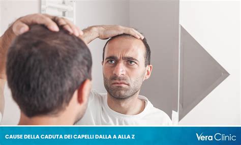 cause della caduta dei capelli