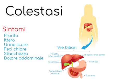 Illustrazione del processo di colestasi e ittero