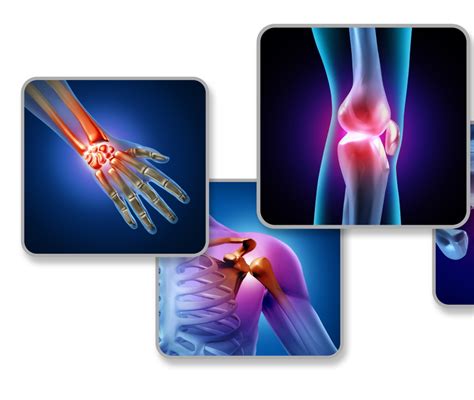 Rappresentazione artistica di articolazioni sane