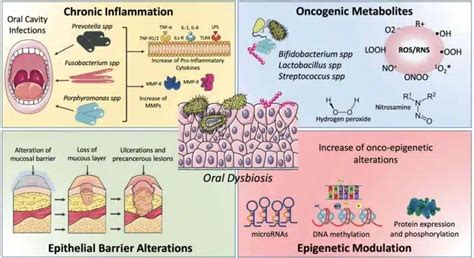 Schema del microbiota orale
