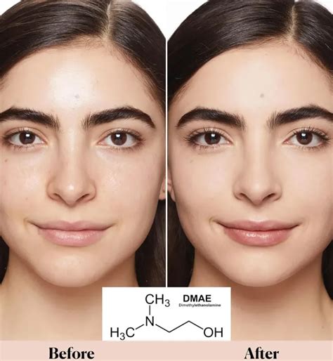 Schema che illustra l'azione combinata di Silicio Organico e DMAE sulla pelle