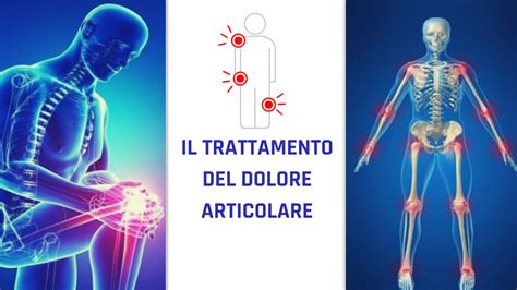 Grafico che mostra la riduzione del dolore articolare con l'assunzione di glucosamina