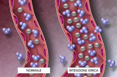 Infografica: Come la bromelina agisce sulla ritenzione idrica