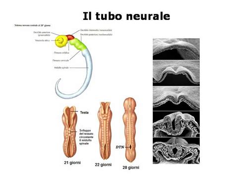 Infografica sui difetti del tubo neurale e l'importanza dell'acido folico