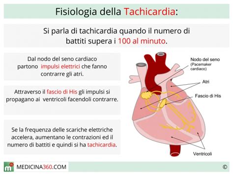Grafico che illustra i passaggi diagnostici per la tachicardia da cause digestive
