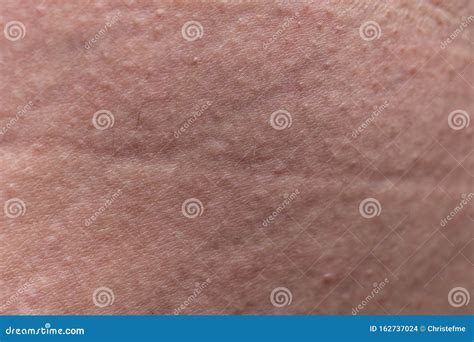 Immagine macro pelle sana con Omega 3