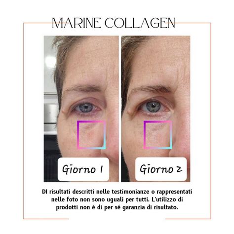 Prima e dopo l'integrazione di collagene marino sulla pelle