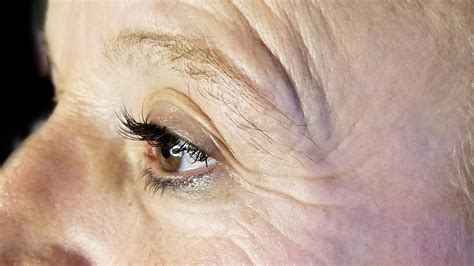 Immagine che mostra i cambiamenti della pelle in menopausa (rughe, perdita di tono)