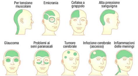 Diagramma con consigli per la gestione del mal di testa