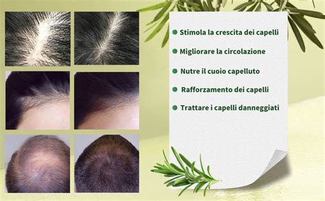 Infografica che mostra i benefici delle multivitamine per i capelli