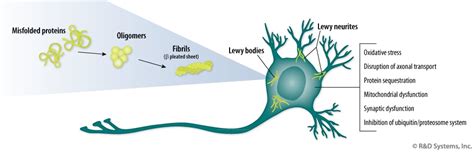 Illustration of alpha-synuclein protein and its role in Parkinson's disease