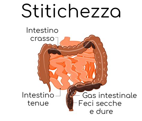 Schema delle cause della stitichezza