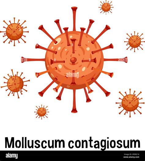 Illustrazione del virus del Mollusco Contagioso