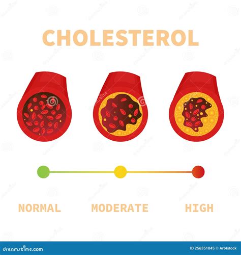 Diagramma dei livelli di colesterolo nel sangue