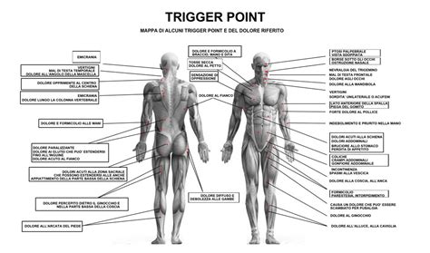 Mappa dei tender points nel corpo umano