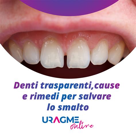 infografica sui danni dello smalto dei denti causati da cibi acidi