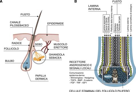 Schema di un follicolo pilo-sebaceo e dei processi infiammatori associati all'acne