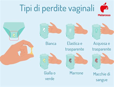 Infografica sui diversi tipi di vaginite e le loro cause