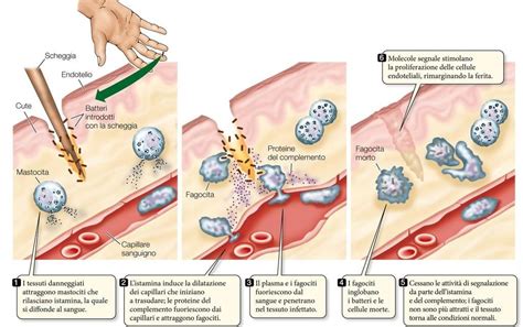 Schema che illustra i meccanismi di infiammazione e disfunzione mitocondriale nell'emicrania