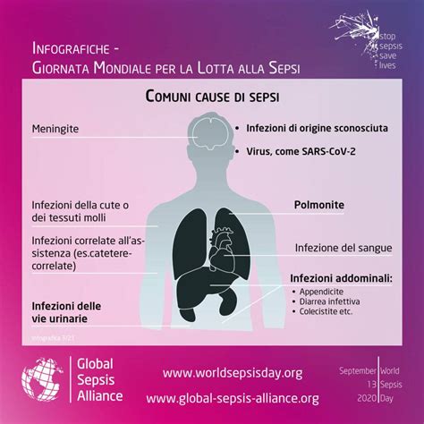 Infografica sulle cause comuni della sete eccessiva