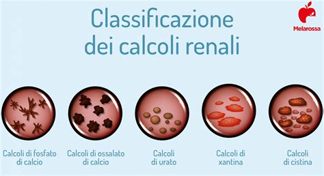 Schema che illustra i benefici del magnesio nella prevenzione dei calcoli renali.