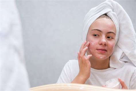Adolescente che applica crema viso